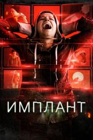Смотреть онлайн Имплант